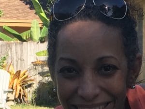 plastic surgery in miami, hair implant in miami, micro-hair transplant in miami, micro-hair restoration transplant in miami, hair restoration in miami