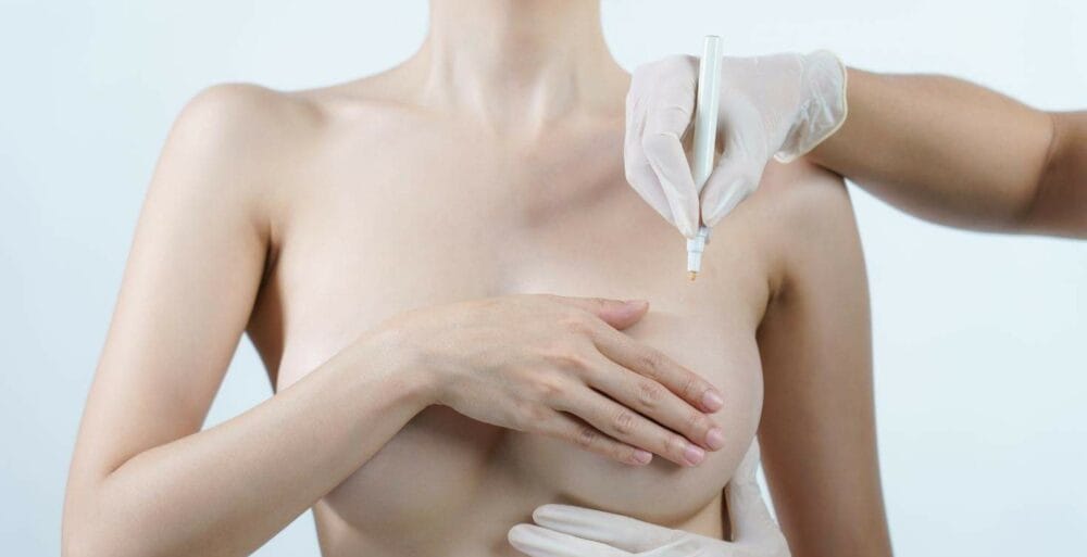 7 breast reduction recovery tips