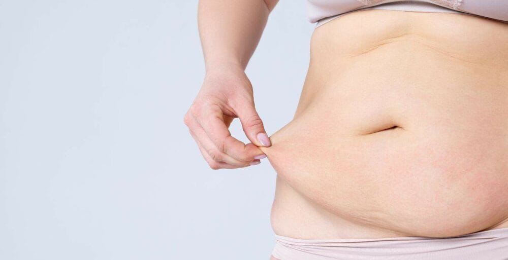 Tummy tuck or liposuction — which one is right for me?