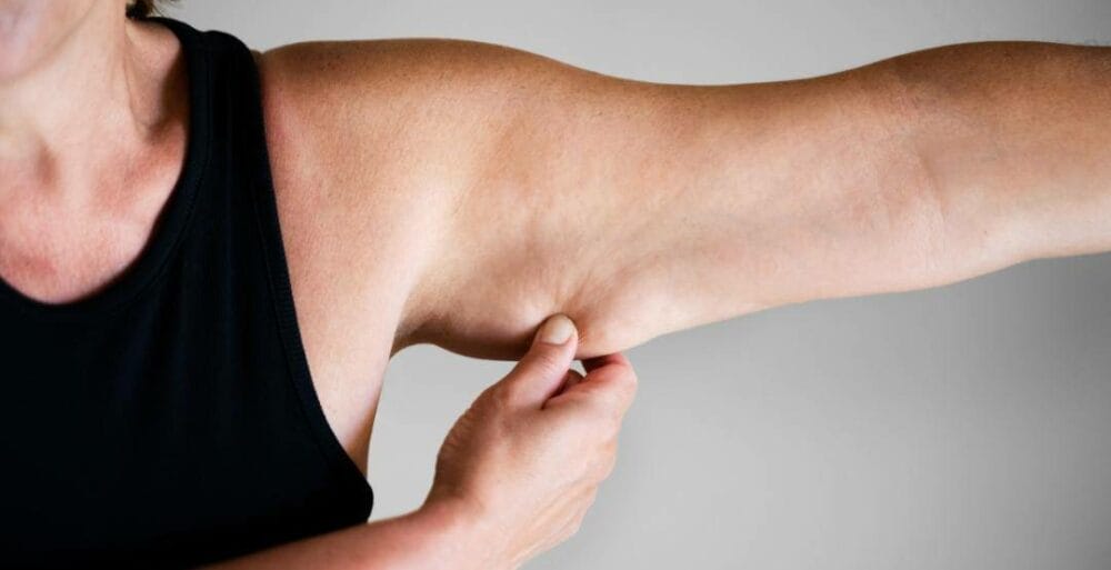 Is arm lift surgery worth it?