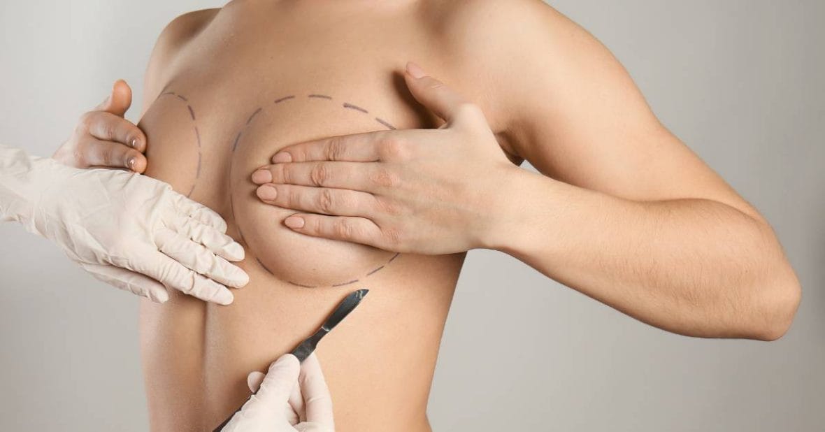Ideal Candidate for Breast Augmentation in Miami
