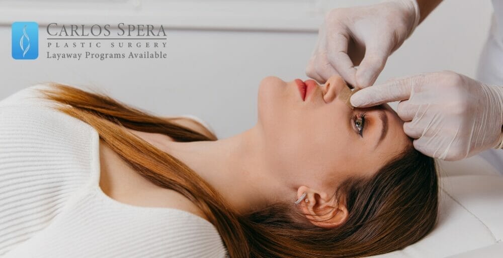 Rhinoplasty in Miami: Comprehensive Guide by Dr. Spera
