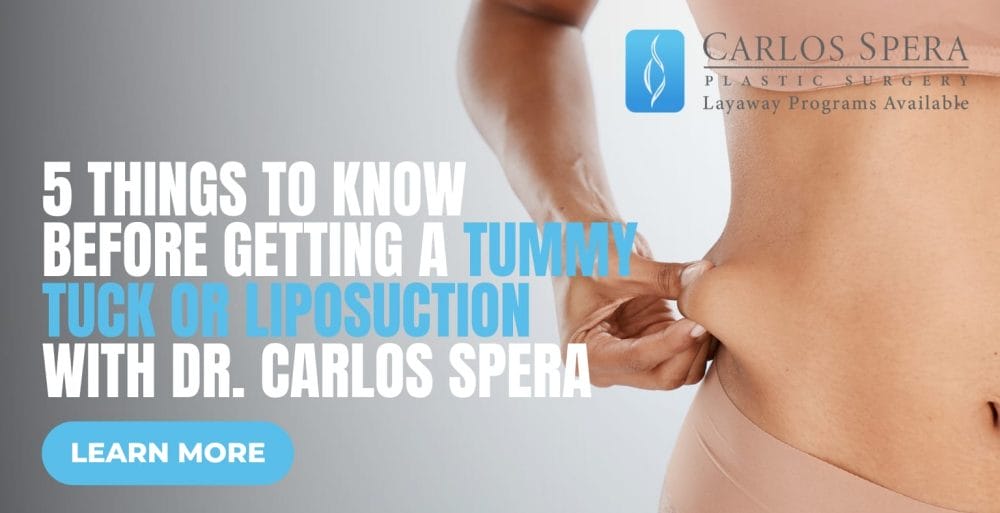 5 Essential Insights Before Opting for a Tummy Tuck or Liposuction with Dr. Carlos Spera