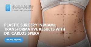 Plastic Surgery in Miami | Transformative Results with Dr. Carlos Spera