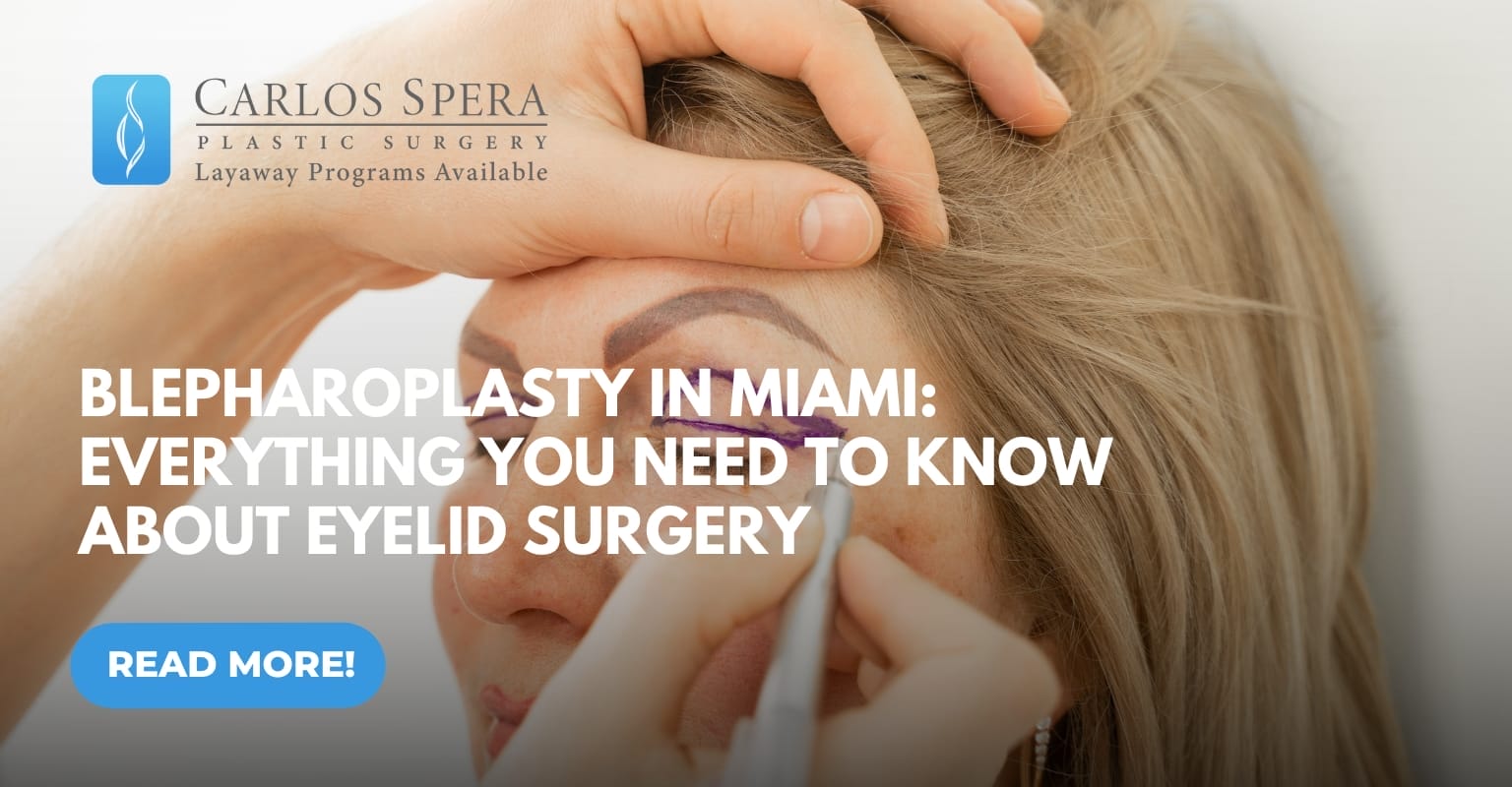 Blepharoplasty in Miami | Everything You Need to Know About Eyelid Surgery