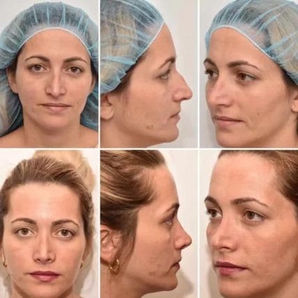 carlossperamd_57166288_294210808159221_3308449182740903605_n