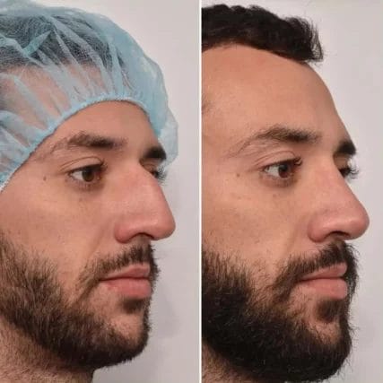 carlossperamd_59337486_668328583623981_8406834833493479803_n