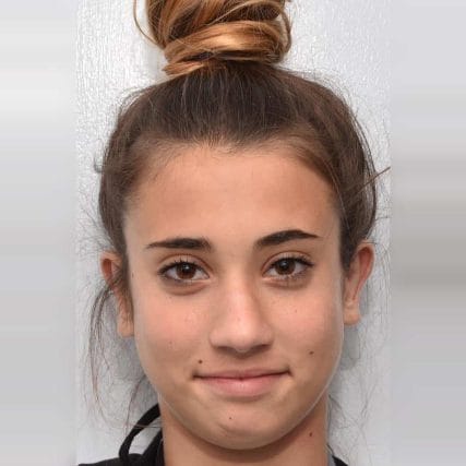 ear-surgery-miami-carlos-spera-14