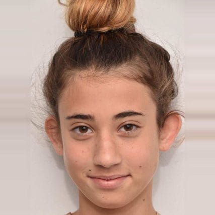 ear-surgery-miami-carlos-spera-6