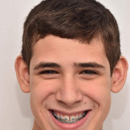 ear-surgery-miami-carlos-spera-7